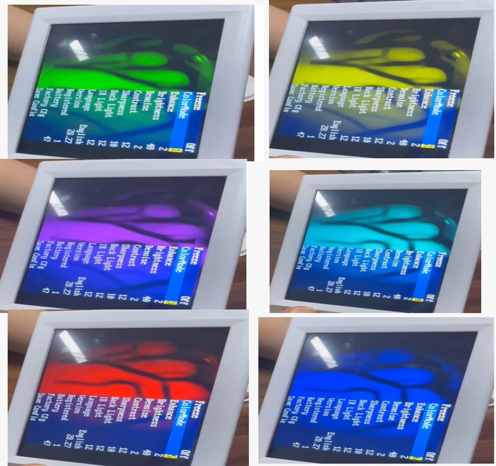 Agentur Addition GmbH - Akquise, Vertrieb und Beratung - Blutzuckermessgerät