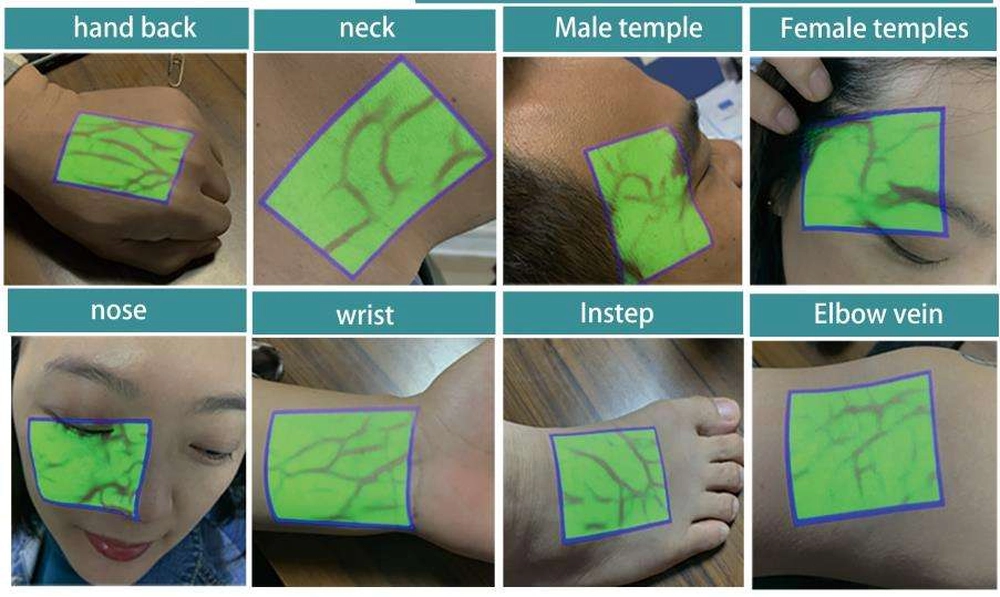 Agentur Addition GmbH - Akquise, Vertrieb und Beratung - Endoskopie